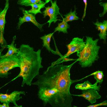 BPAE-cells-(widefield-fluorescence,-DAPI-nuclei,-MitoTracker®-Red-CMXRos-mitochondria,-Alexa-Fluor®-488-phalloidin-F-actin,-10x-obj-).png