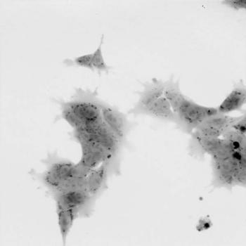 Colony-of-human-embryonal-stem-cells-(HESC)-(QPI,-10x-obj-).jpg