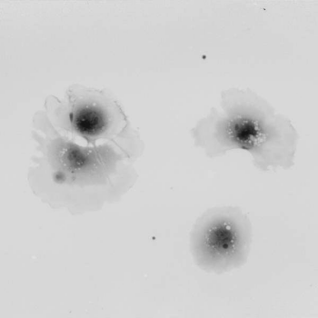 Human-embryonal-fibroblasts-(QPI,-10x-obj-).png