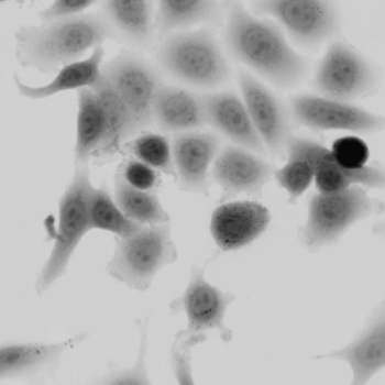 Metastatic-breast-cancer-cell-line-MDA-MB-231-(QPI,-10x-obj-).png