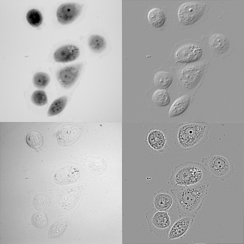 Human-ovarian-cancer-cell-line-A2780-(QPI,-20x-obj-).png