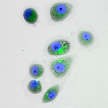 A2780-cells-(QPI-widefield-fluorescence,-DAPI-nuclei,-CYTO-ID®-autophagic-vacuoles,-20x-obj-).png