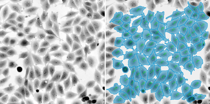 PC-3-cells-(segmentation-of-QPI-data,-10x-obj-).png