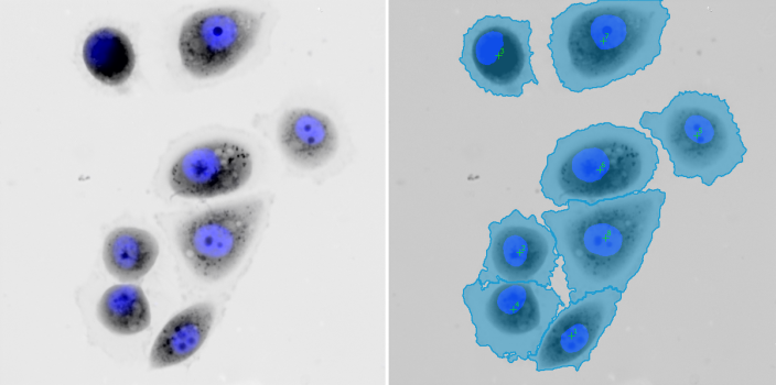 A2780-cells-(segmentation-of-QPI-data-with-correction-by-DAPI-nuclear-fluorescence,-20x-obj-).png